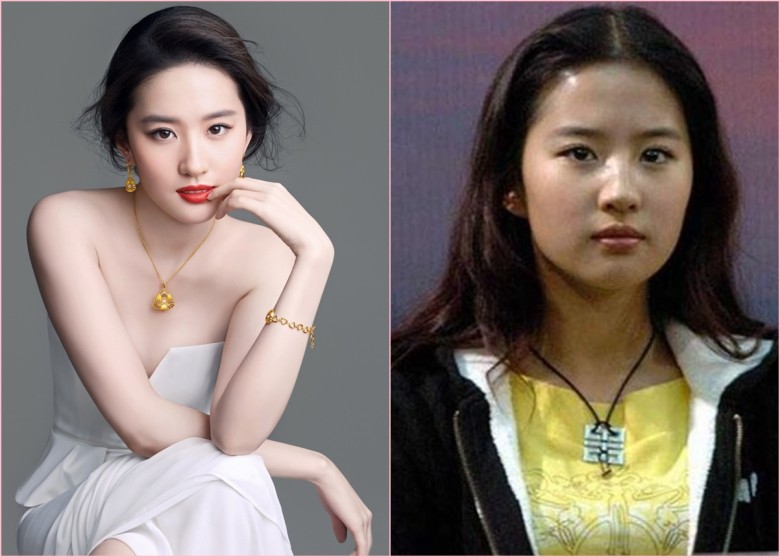 網友將劉亦菲的新（左圖）舊照片作對比，力指她改眉形、眼部、鼻、面曾經改形及隆下巴。