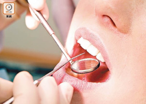 免費口腔檢查今起登記　學會冀市民培養定期洗牙習慣