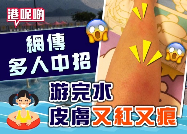 泳池氯氣易致敏？小童身痕兼出疹!專家教你點預防｜即時新聞｜港澳｜on.cc東網